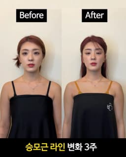센터 사진